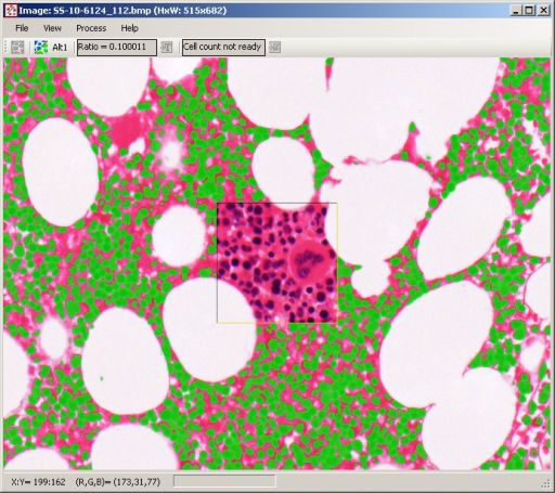 Histocytometer